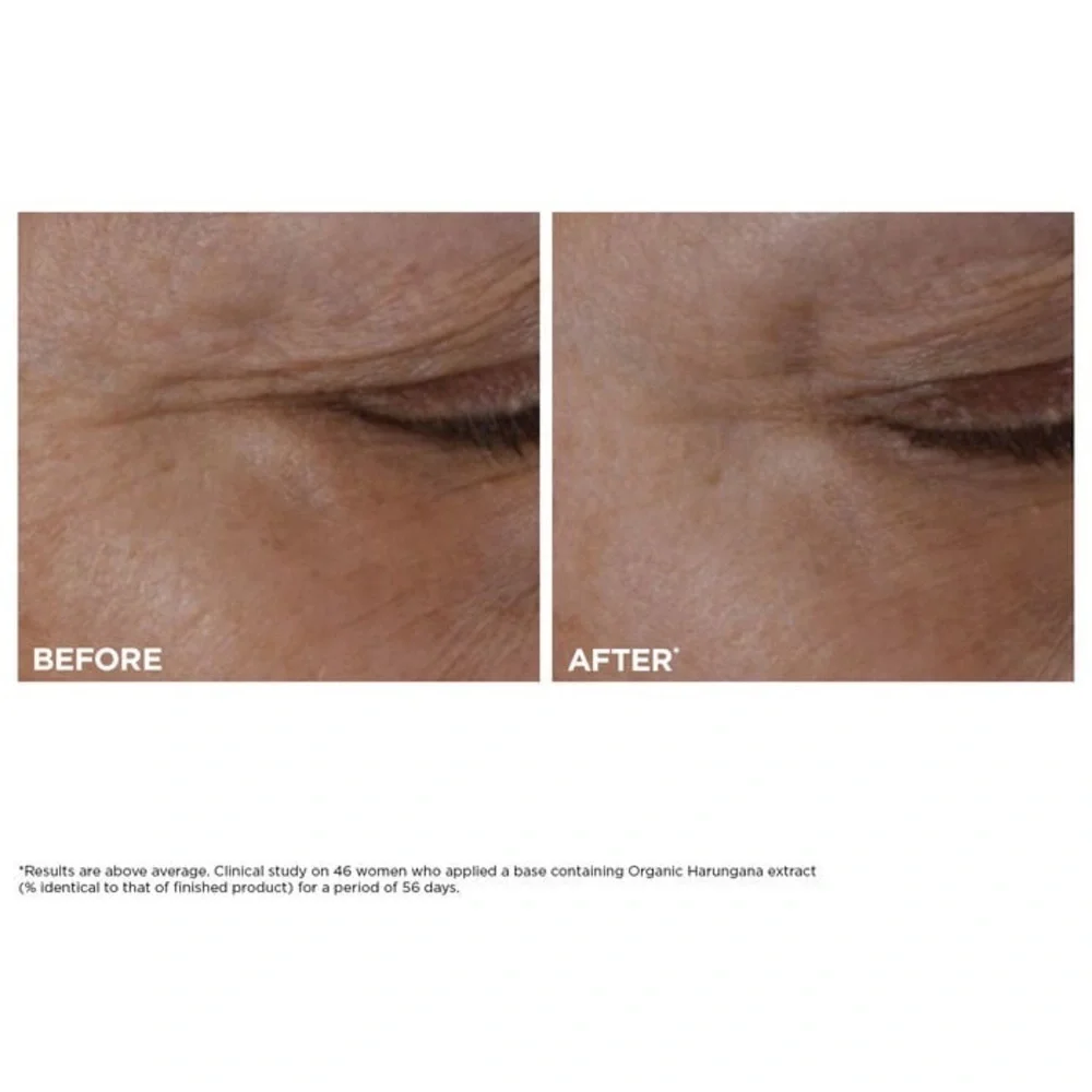 NEW 10xClarins Total Eye Lift Eye Cream 3ML (Sample/Travel Size)